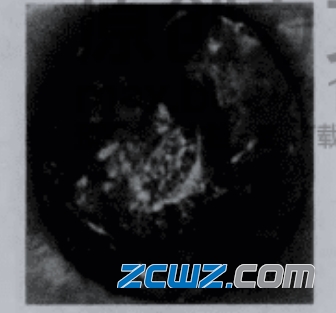 泵用推力球轴承磨损失效故障举例说明