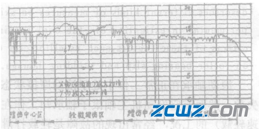 滚子轴承打滑蹭伤因素及轴承防滑措施